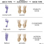 foot-arch-type-photo